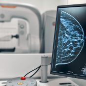 Equipo Clarity 3D - Ideal para realizar tomosíntesis digital mamaria