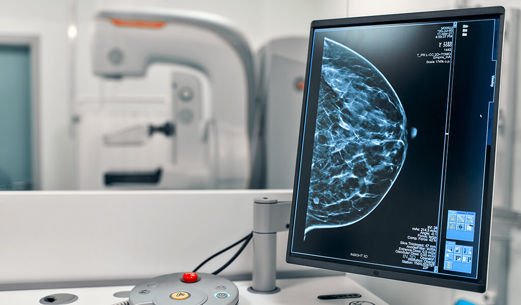 Equipo Clarity 3D: Ideal para realizar tomosíntesis digital mamaria