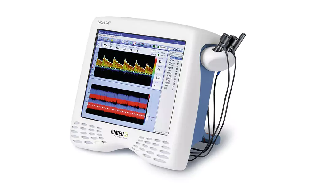 Monitoreo del flujo sanguíneo cerebral: Ventajas al usar Doppler Transcraneal