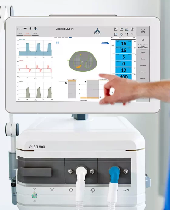 tomografía por impedancia eléctrica